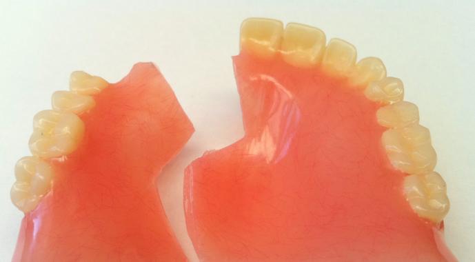 Чем склеить зубной протез в домашних условиях, чем лучше фиксировать